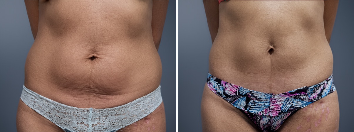 A result from David W. Allison, MD