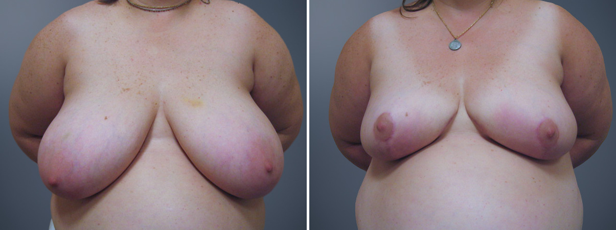 A result from David W. Allison, MD