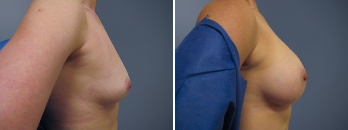 A result from David W. Allison, MD