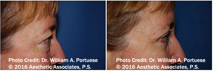 The Portland Center For Facial Plastic Surgery provider photo