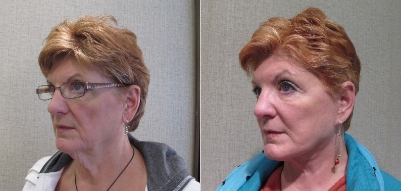 A result from John S. Lee, MD