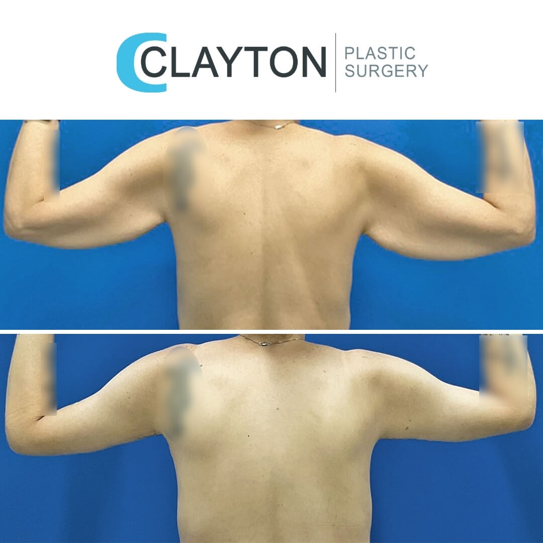 A result from John L Clayton MD