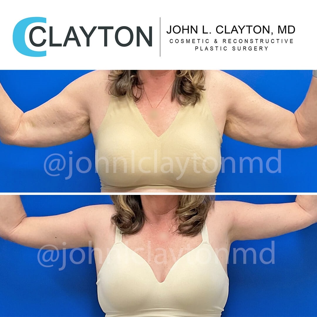 A result from John L Clayton MD