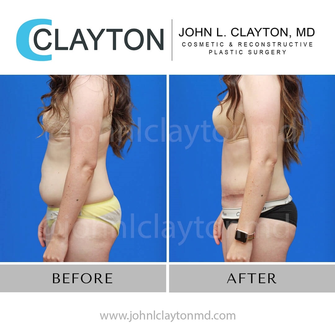 A result from John L Clayton MD