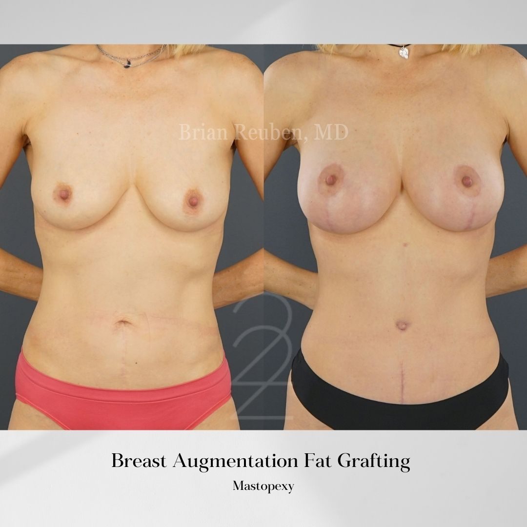 A result from 22 Plastic Surgery & Spa MD