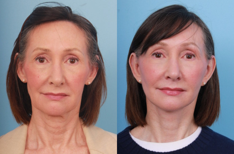 Faces First provider photo