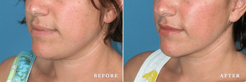 Faces First provider photo