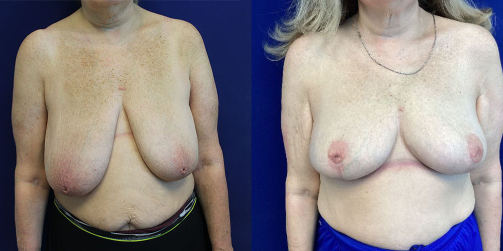 A result from Jason Cooper, MD
