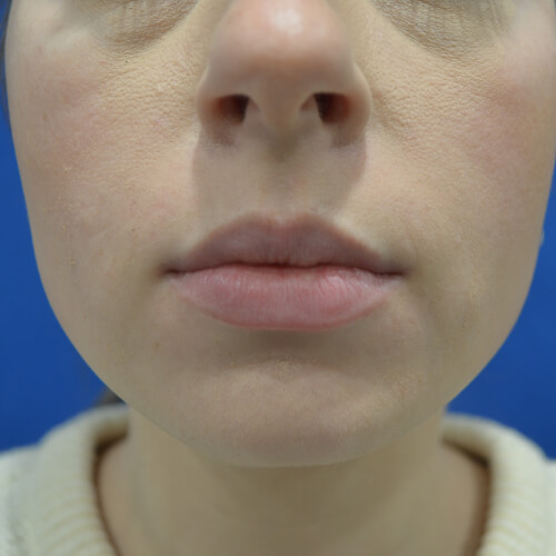 Philadelphia Facial Plastic Surgery & Medspa provider photo