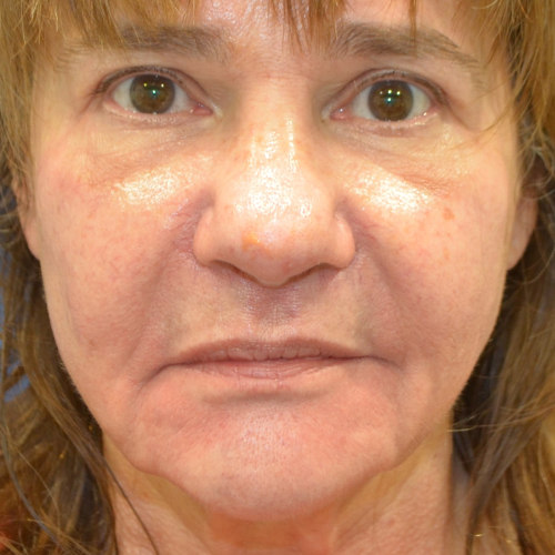 Philadelphia Facial Plastic Surgery & Medspa provider photo