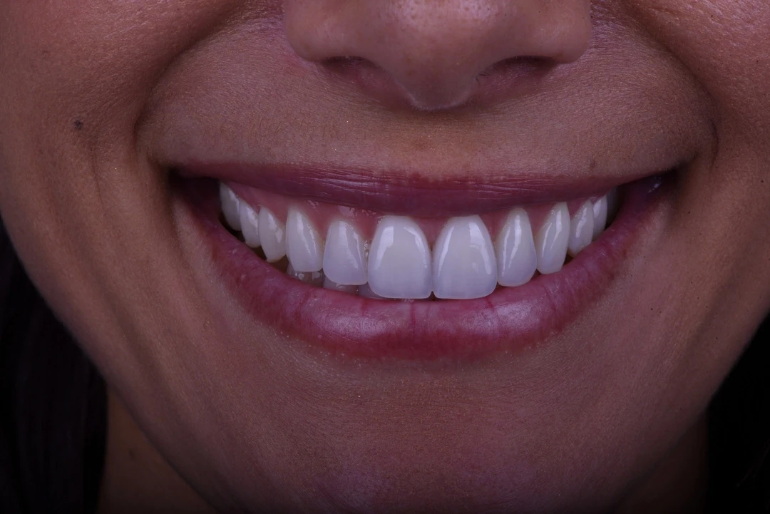 A result from Carlsbad Beach Dental - Drew Addy, DDS