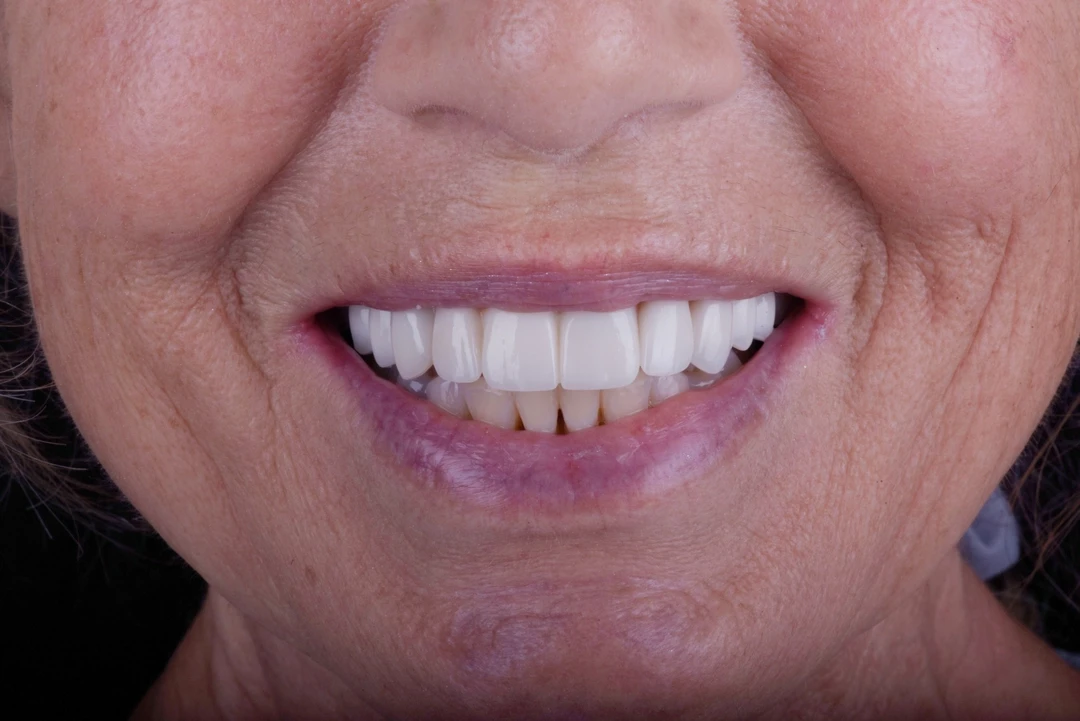 A result from Carlsbad Beach Dental - Drew Addy, DDS