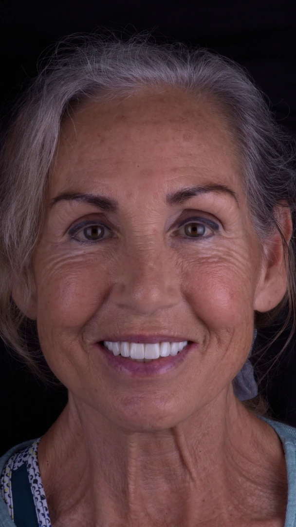 A result from Carlsbad Beach Dental - Drew Addy, DDS