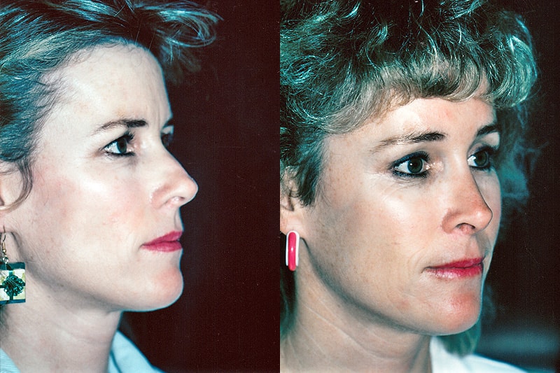 A result from Erwin S Wheeler, MD