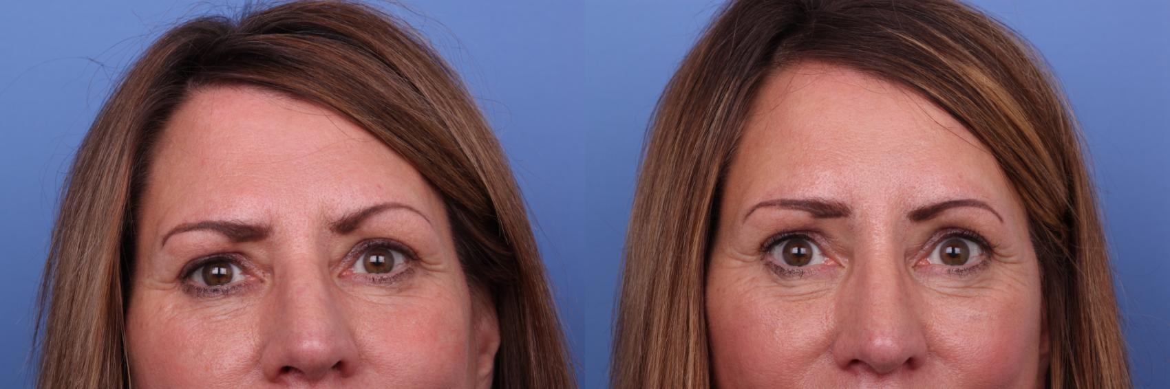 A result from Todd Hobgood, MD