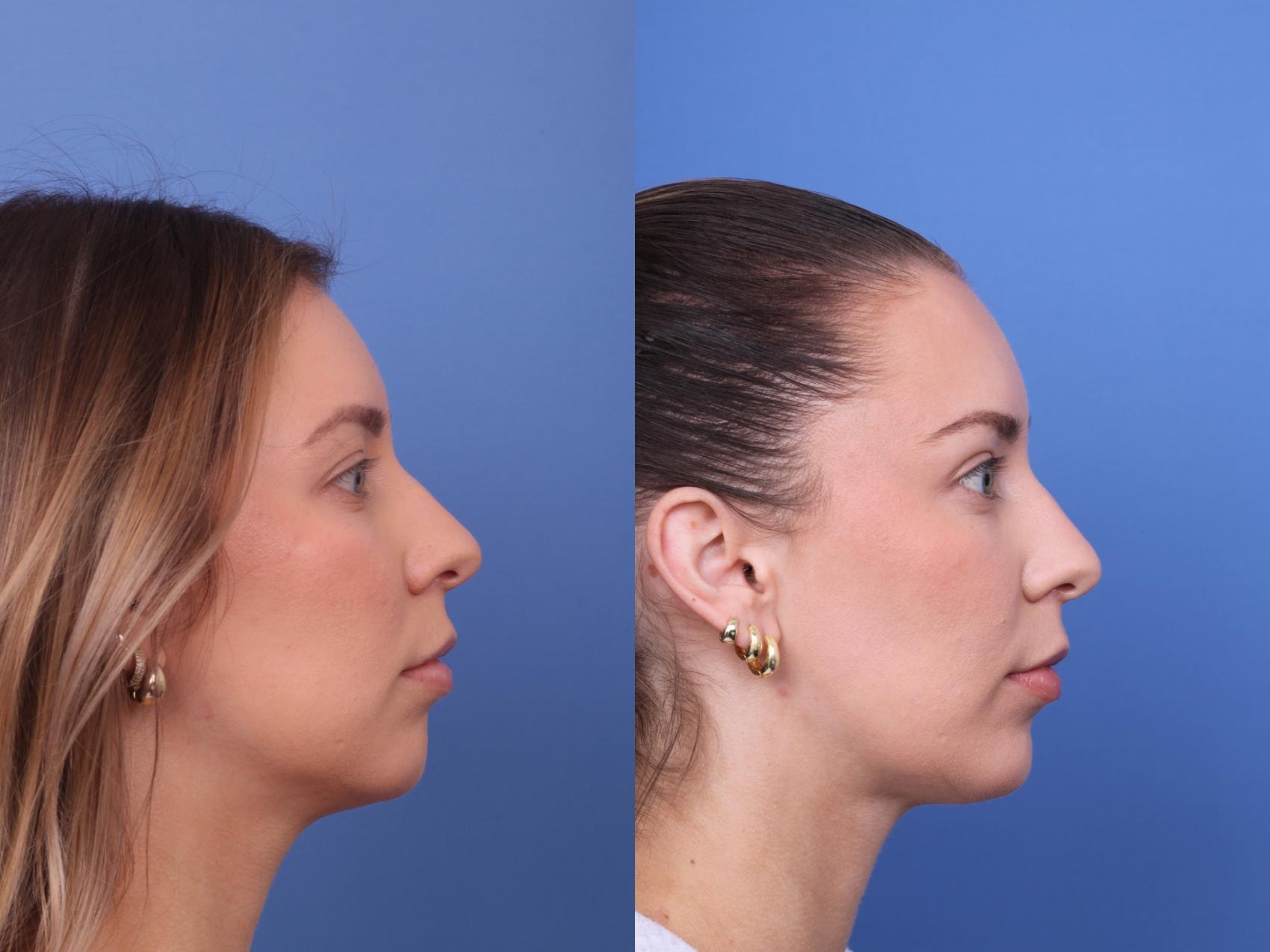 A result from Todd Hobgood, MD