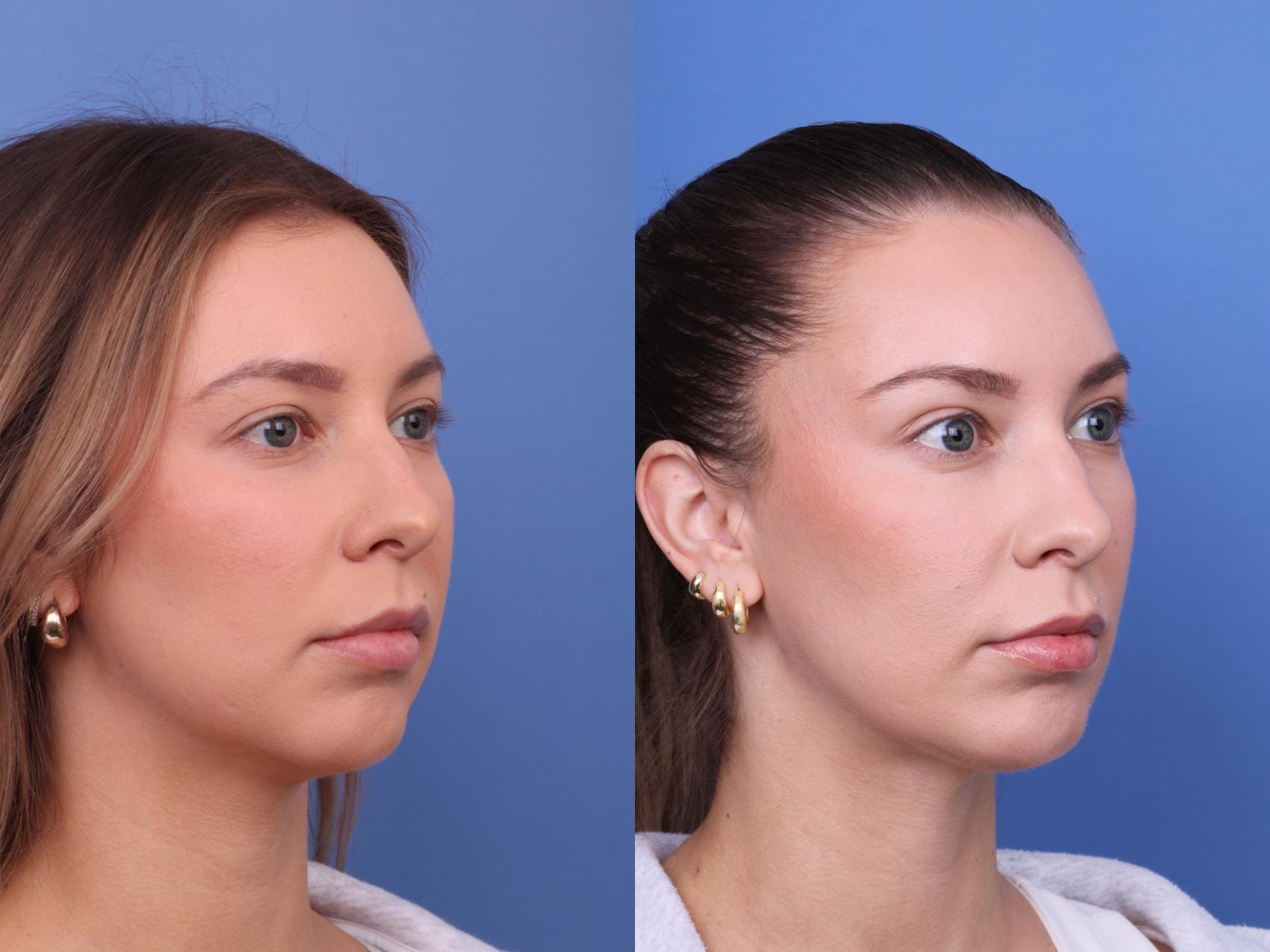 A result from Todd Hobgood, MD