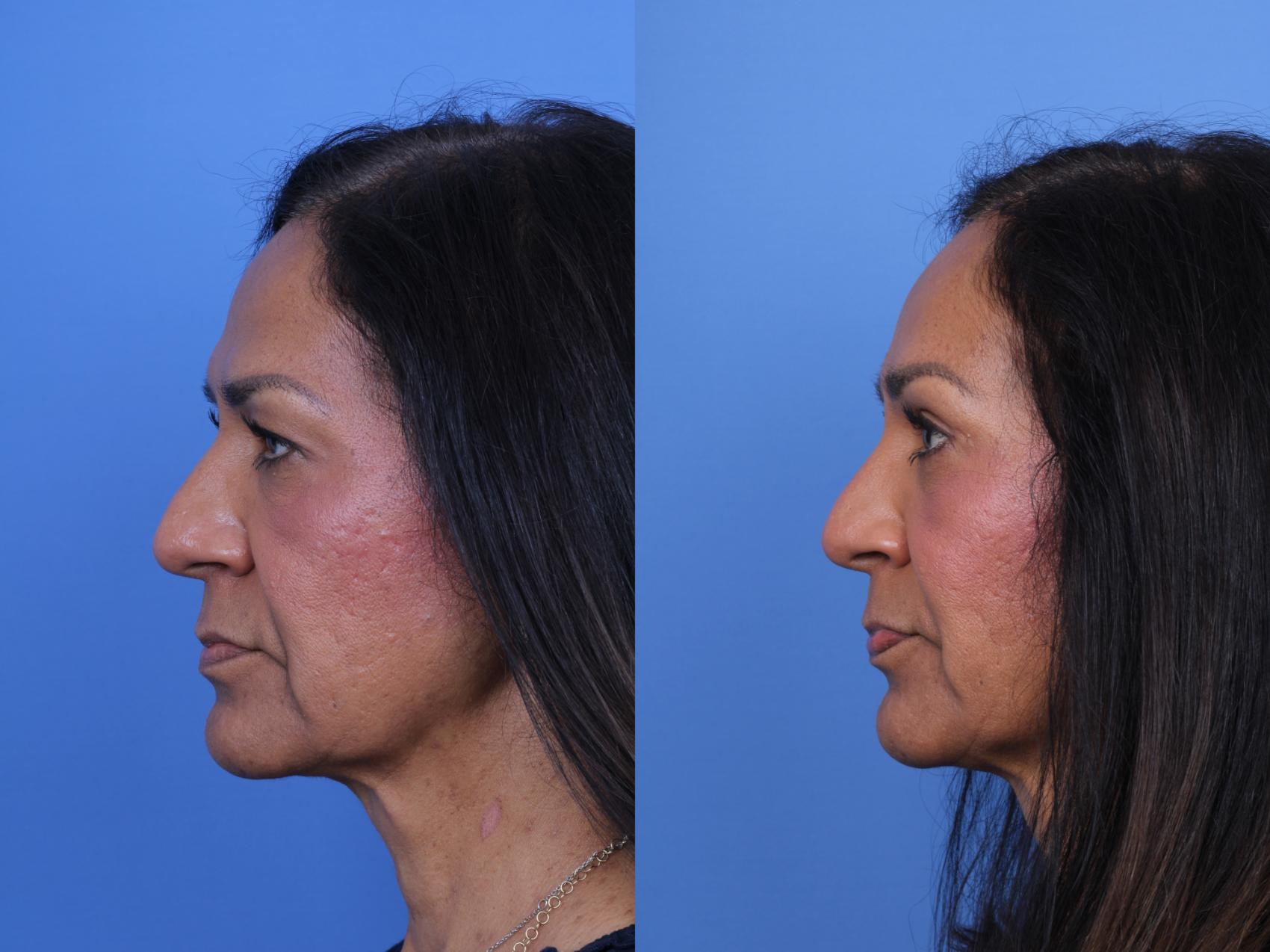 A result from Todd Hobgood, MD