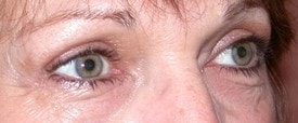 A result from Christopher V. Pelletiere, MD