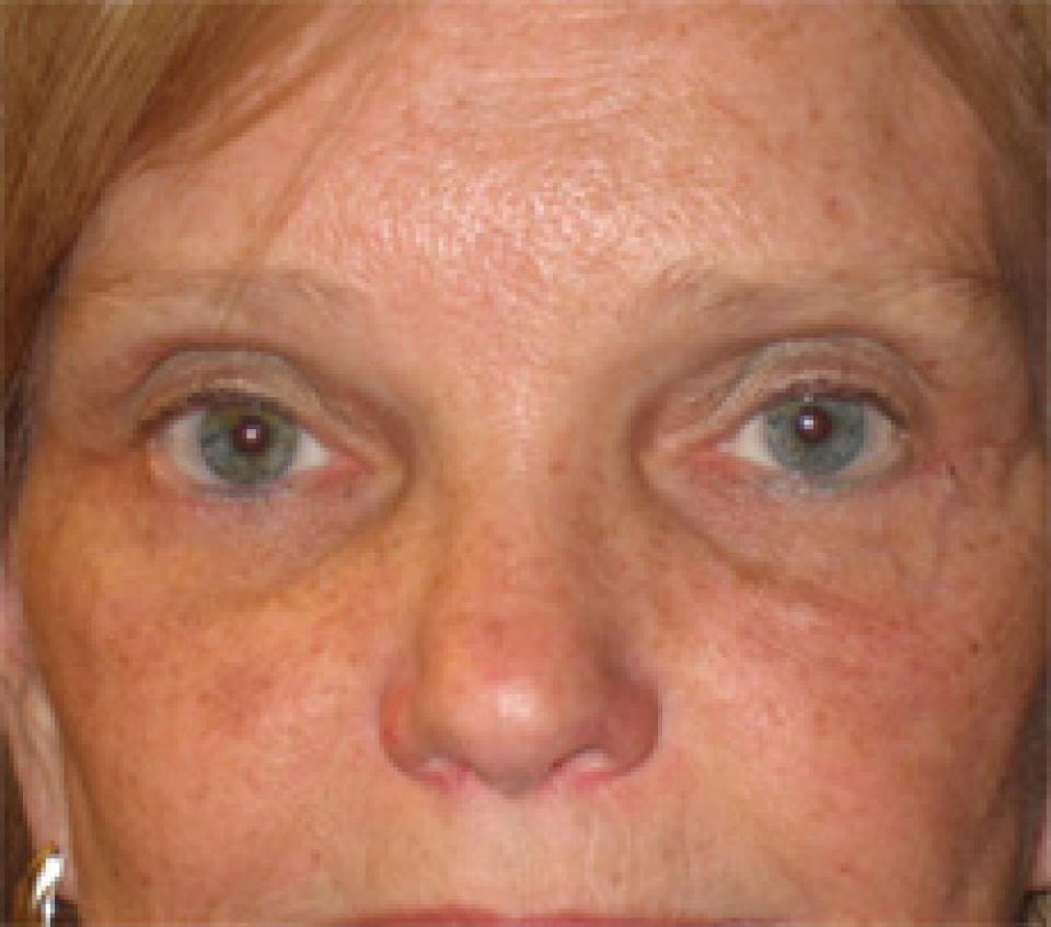 A result from Ksenija Belsley, MD
