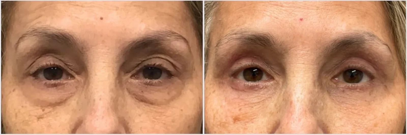 A result from Oculoplastic & Orbital Consultants