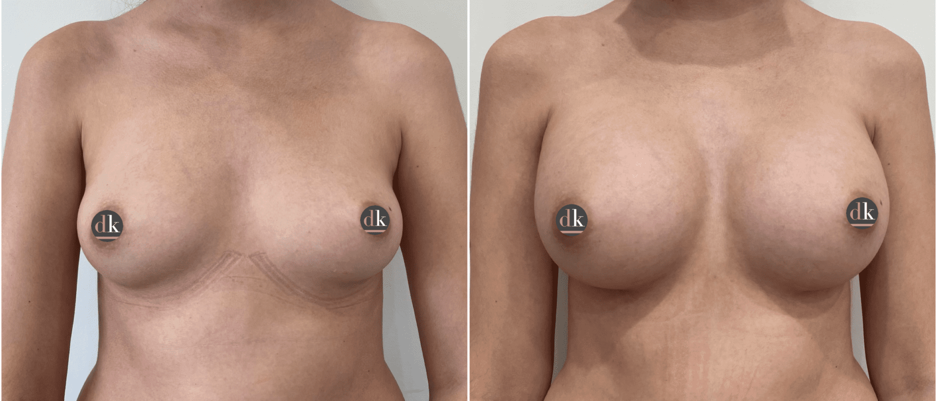A result from Dr. Dana K. Khuthaila