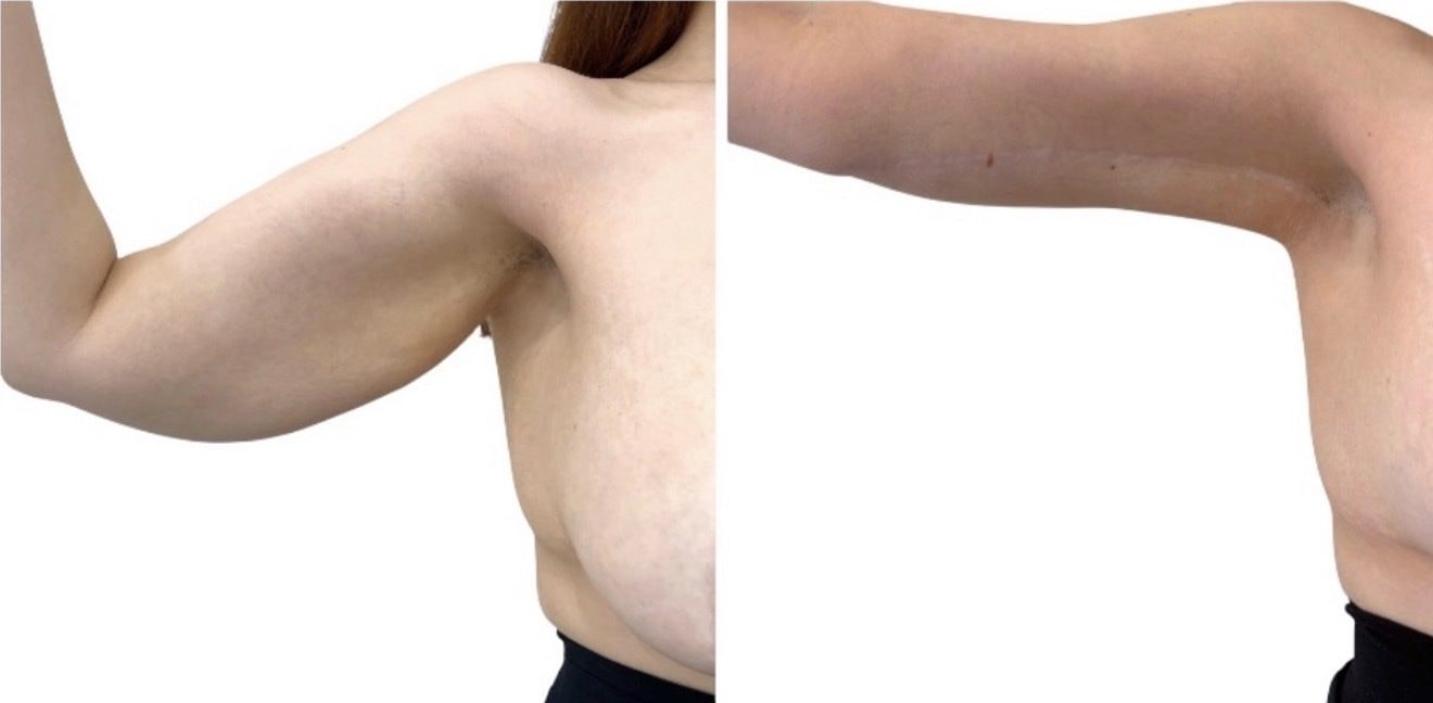 A result from Dr. Dana K. Khuthaila