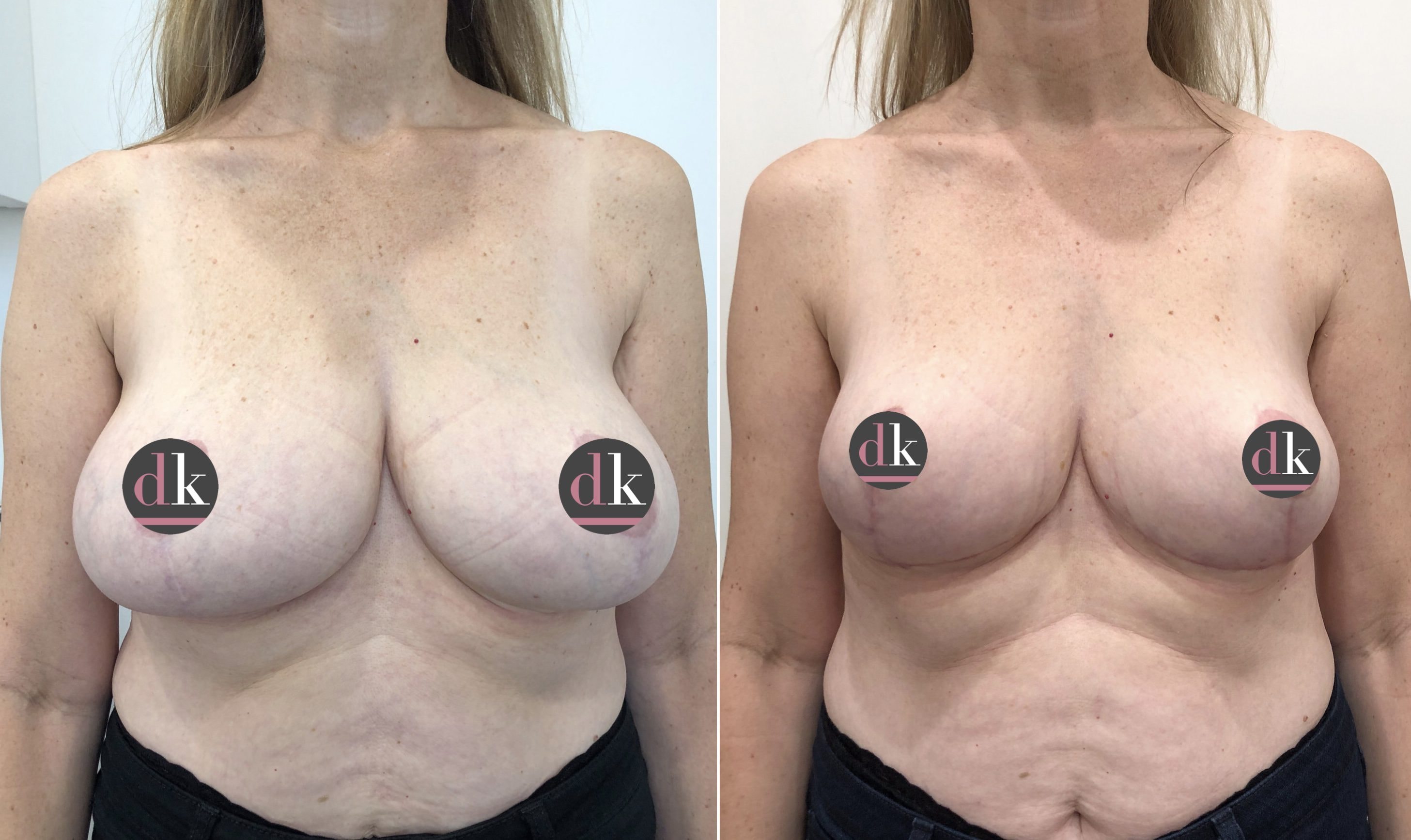 A result from Dr. Dana K. Khuthaila