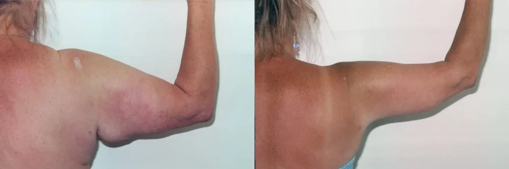 A result from Boris M. Ackerman, MD