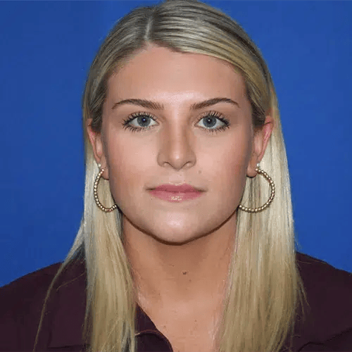 A result from PA Plastic Surgery Center - Dr Paul Warner Papillion