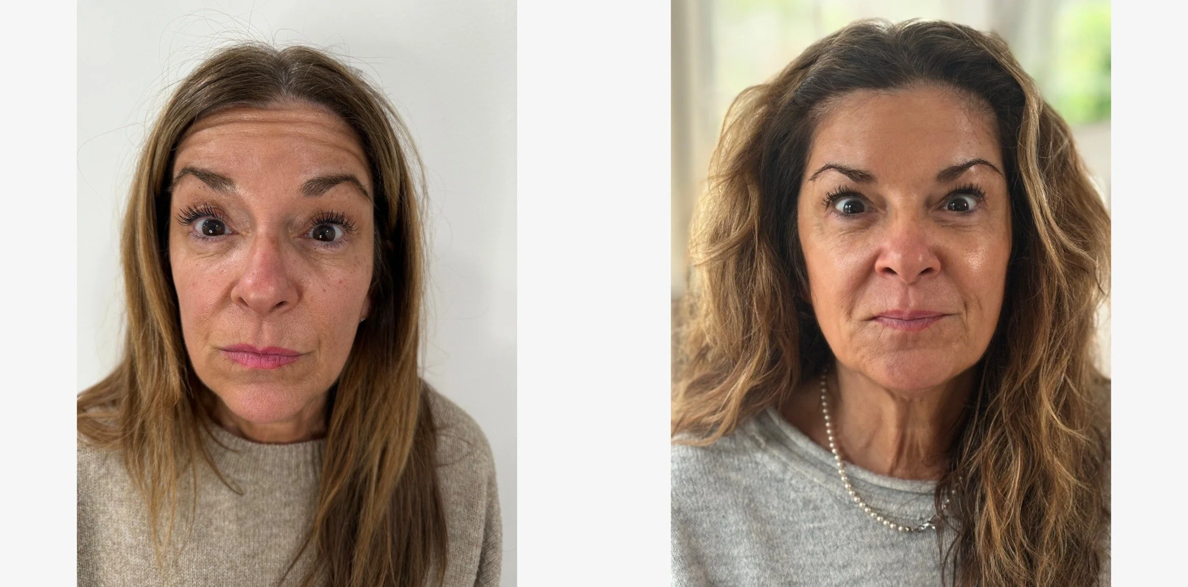 A result from Sola Vie Skin Clinic