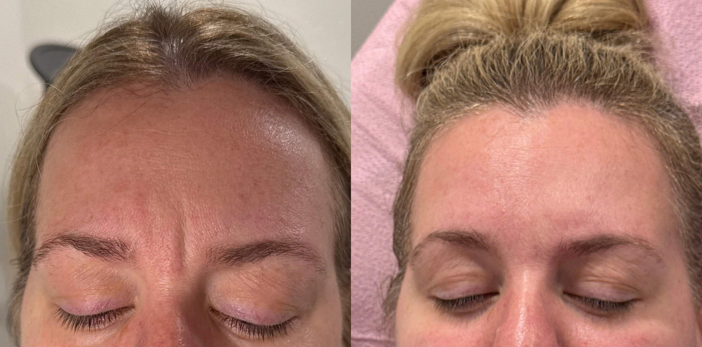 A result from Sola Vie Skin Clinic