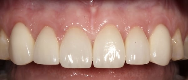 A result from Middle Tennessee Prosthodontics