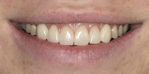 A result from Middle Tennessee Prosthodontics