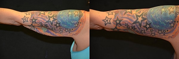 A result from Body By Bloch (Steven Bloch, MD)