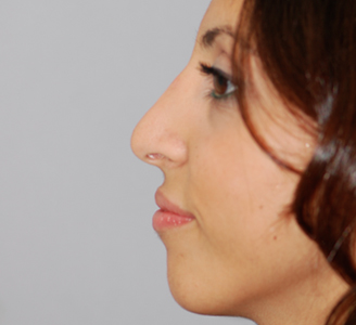 Michigan Facial Aesthetic Surgeons provider photo