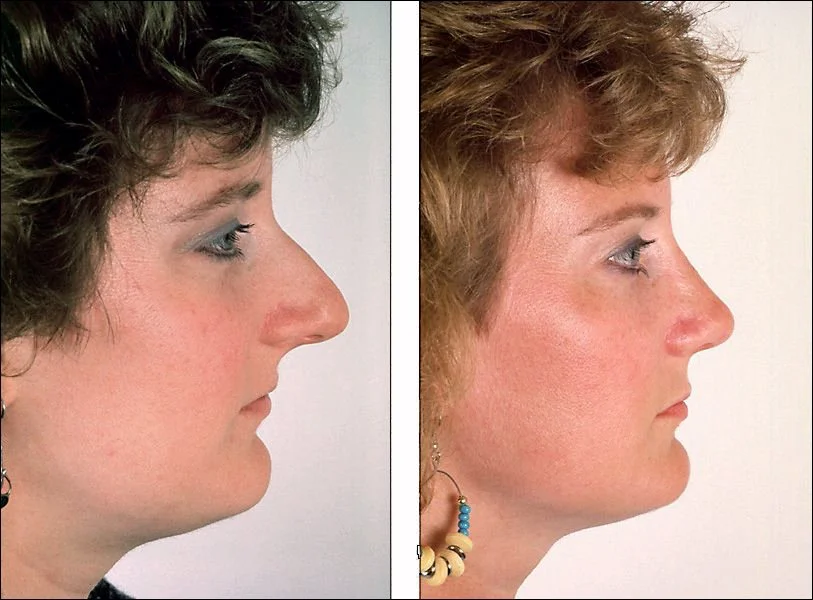 Denenberg Facial Plastic Surgery provider photo