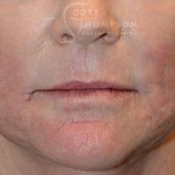 A result from Utah Facial Plastics & UFP Hair Restoration