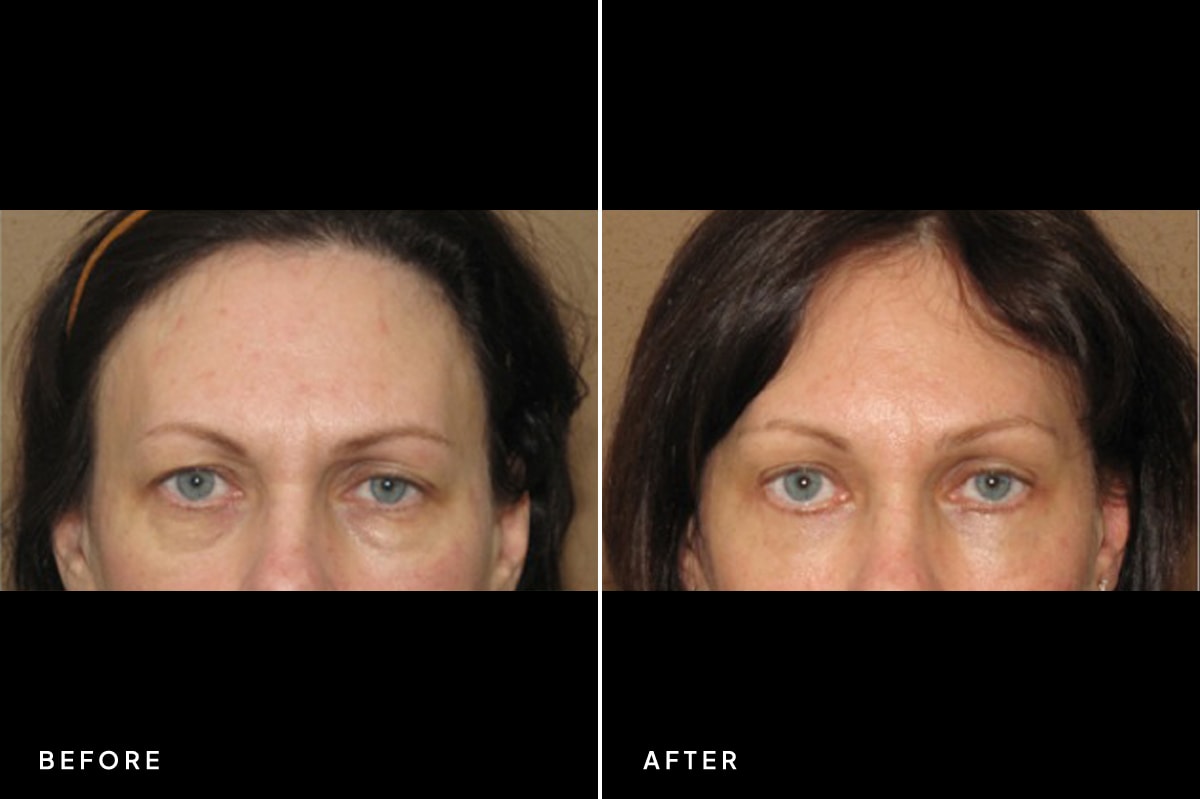 A result from New Horizons Center for Cosmetic Surgery (Gregory A. Turowski, MD)