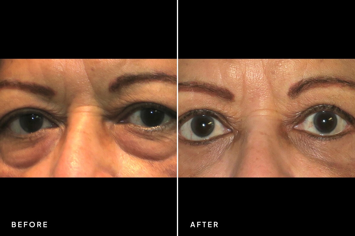 A result from New Horizons Center for Cosmetic Surgery (Gregory A. Turowski, MD)