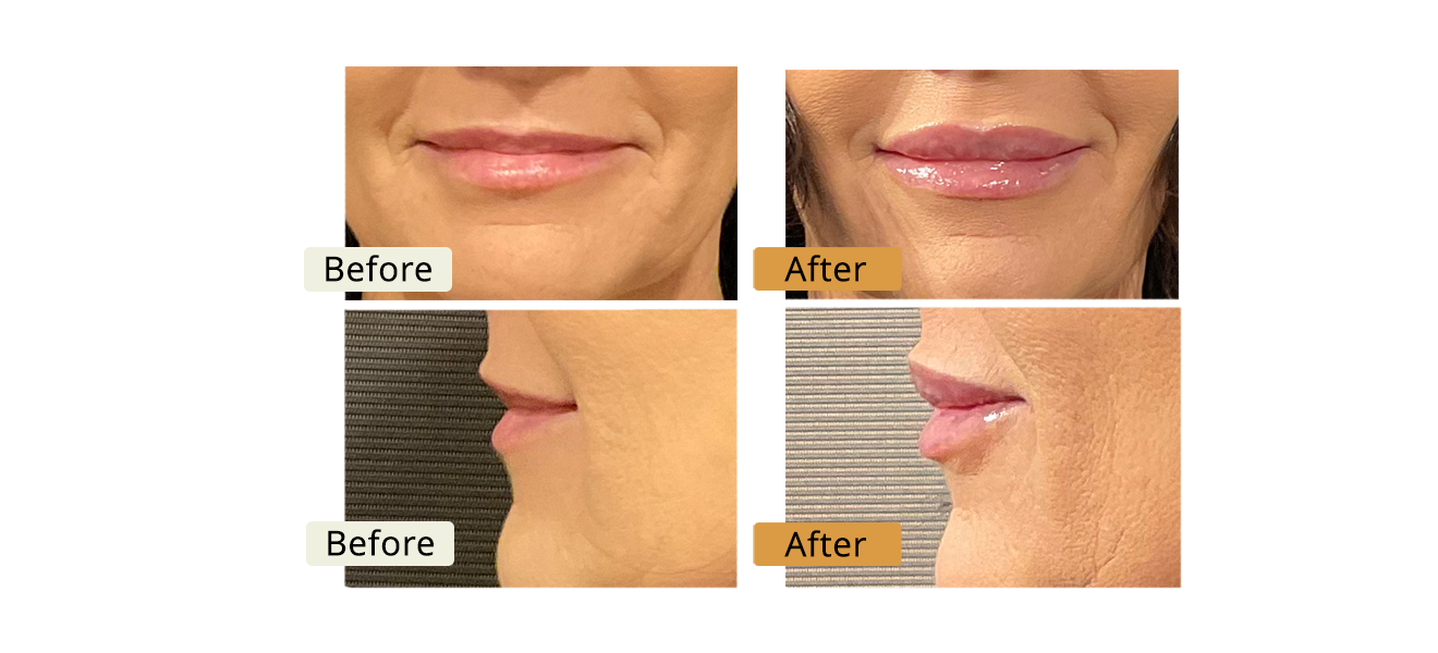 ELE'VI Skin & Medical Aesthetics provider photo