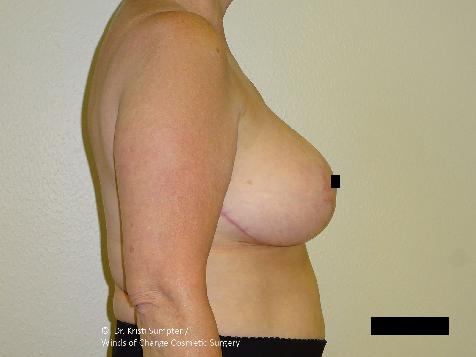 Winds of Change Cosmetic Surgery provider photo