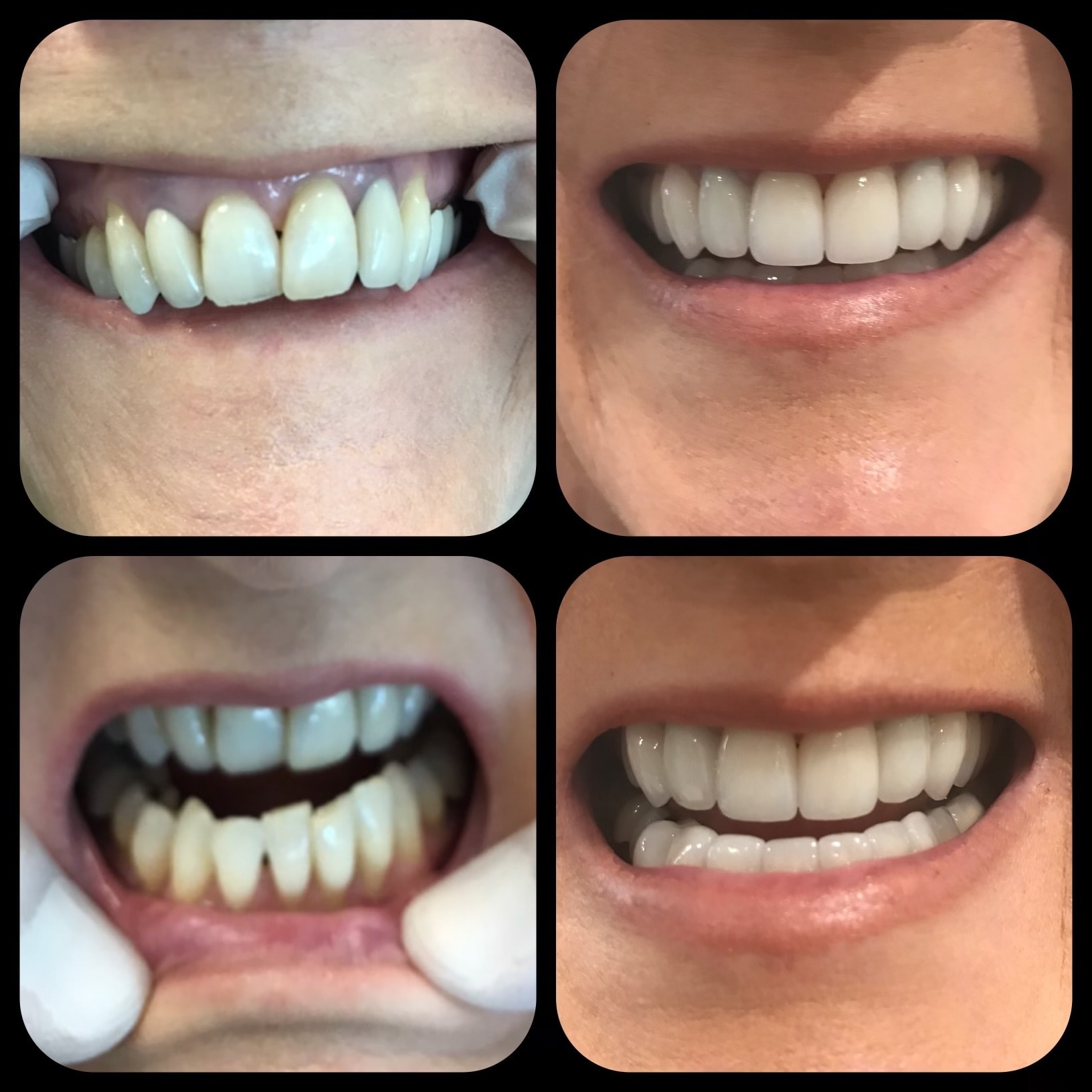 A result from Parkway Dental