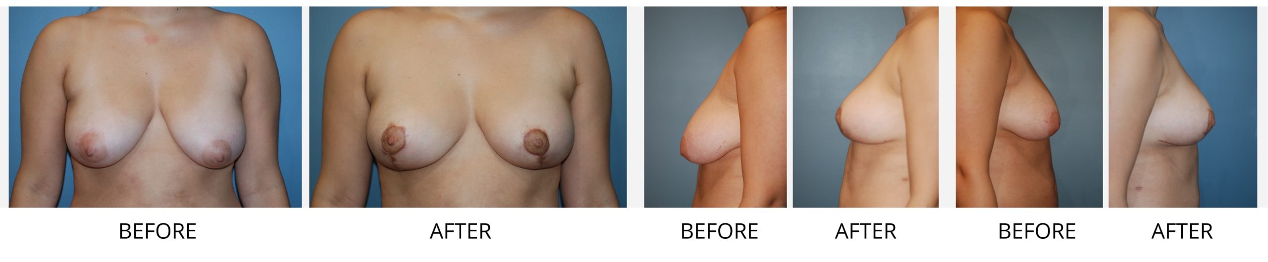 A result from Richard Swift, MD