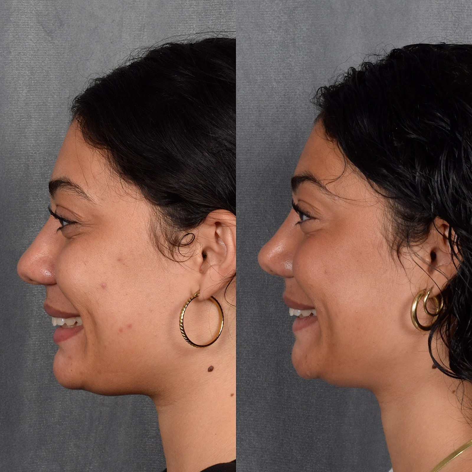 A result from Vegas Facial Plastics