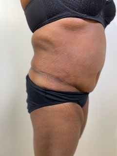 Day Plastic Surgery (Norman Bakshandeh, MD) provider photo