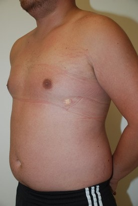 A result from Day Plastic Surgery (Norman Bakshandeh, MD)