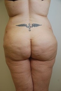 Day Plastic Surgery (Norman Bakshandeh, MD) provider photo