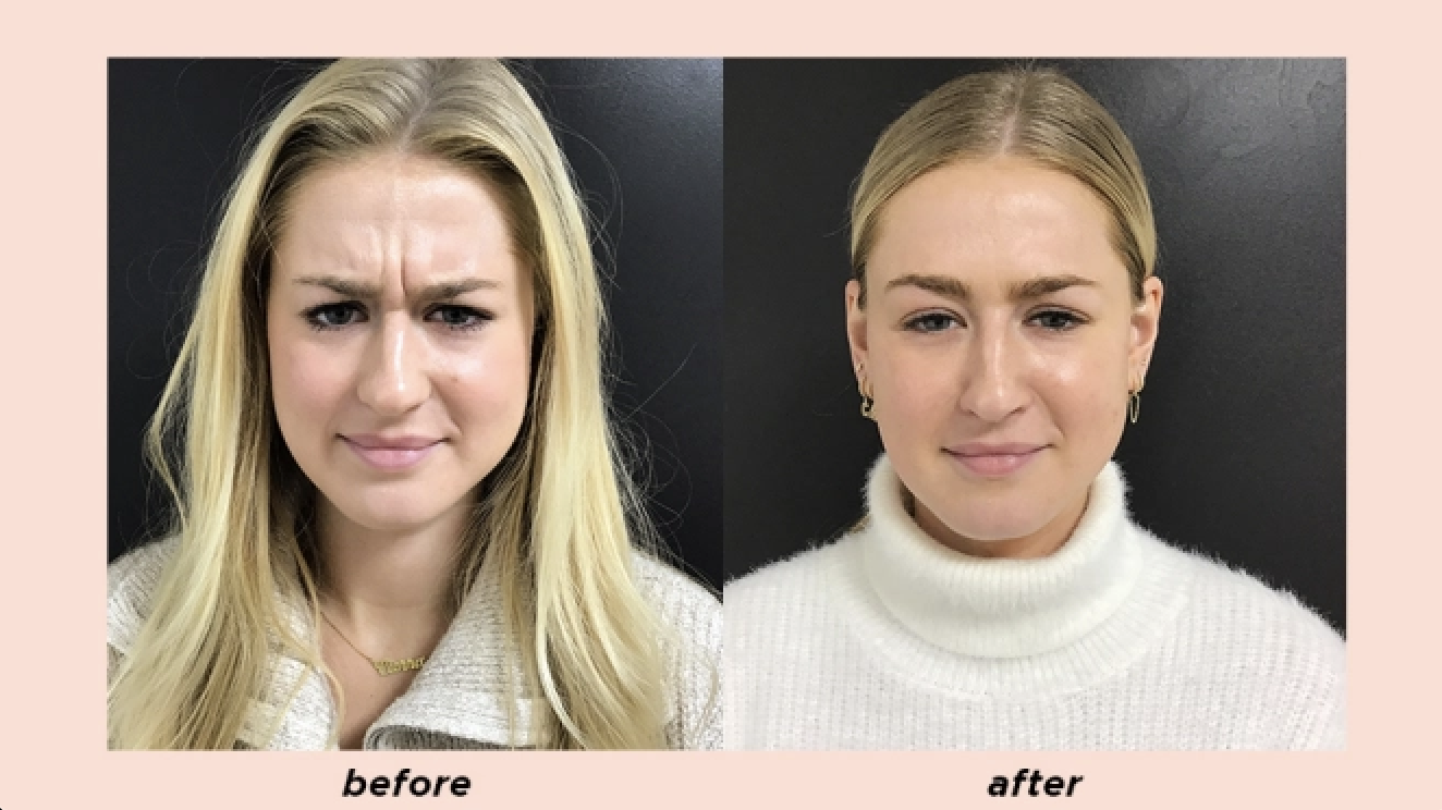 A result from Aesthetic Center of Columbia