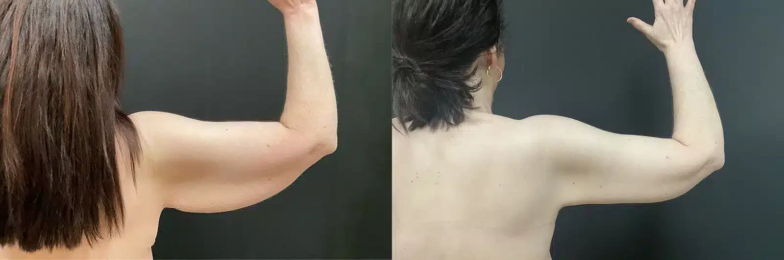 A result from My Plastic Surgery Group